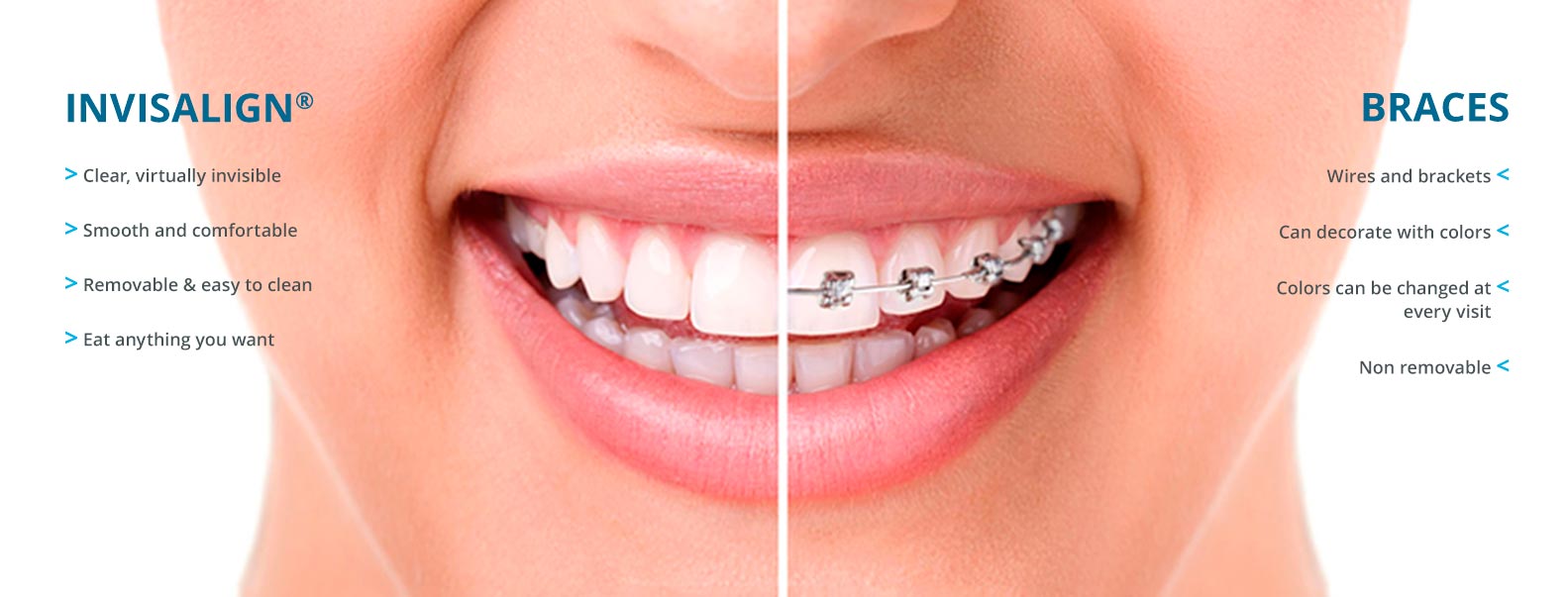 invisalign vs braces | Century Smile Dental