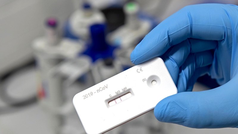 IgG and IgM antibody testing