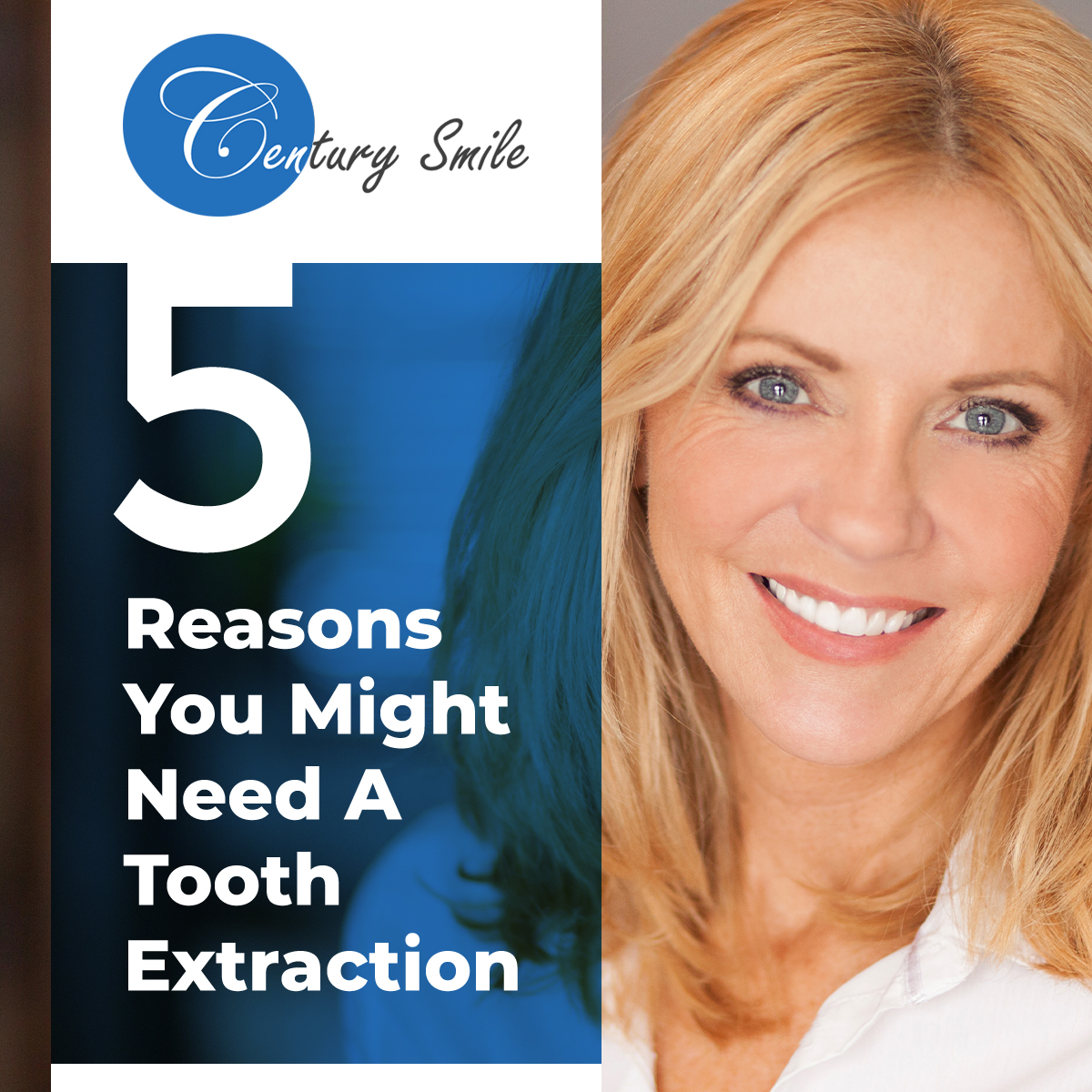 5 Reasons You Might Need A Tooth Extraction - Century Smile Dental - Culver City, Century City, Sunset Park, Castle Heights
