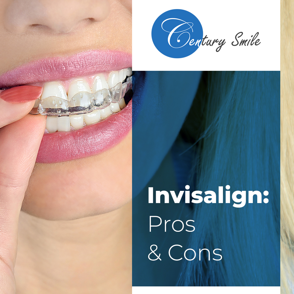 Invisalign Pros and Cons - Century Smile Dental - Century City, Culver City