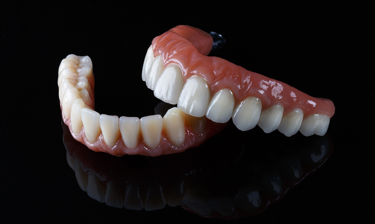 Tooth Restoration - All On 4 Dental Implants